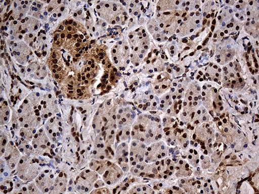 IKBKG / NEMO / IKK Gamma Antibody (clone OTI3C3, Carrier-free)