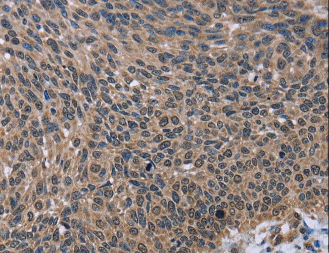 Polyclonal Rabbit anti-Human IMPDH2 Antibody (IHC, WB)