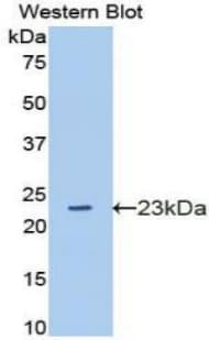 GAS6 Antibody (aa136-311)