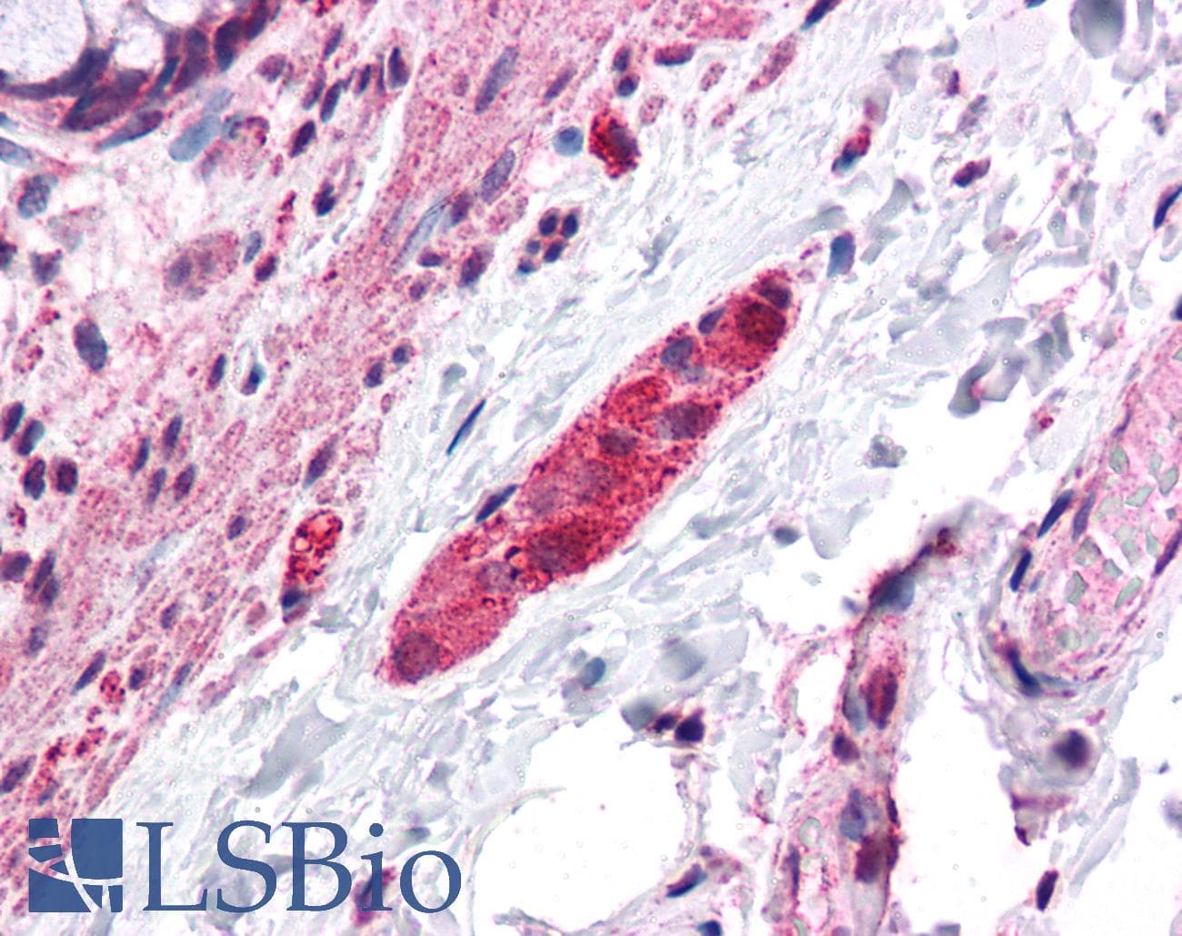 IHC-plus™ DLGAP2 Antibody