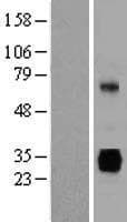 SGCG / Gamma-Sarcoglycan Protein (Over-Expression Lysate Myc-DDK (Flag))
