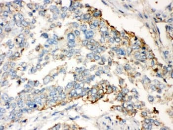 WNT2B Antibody