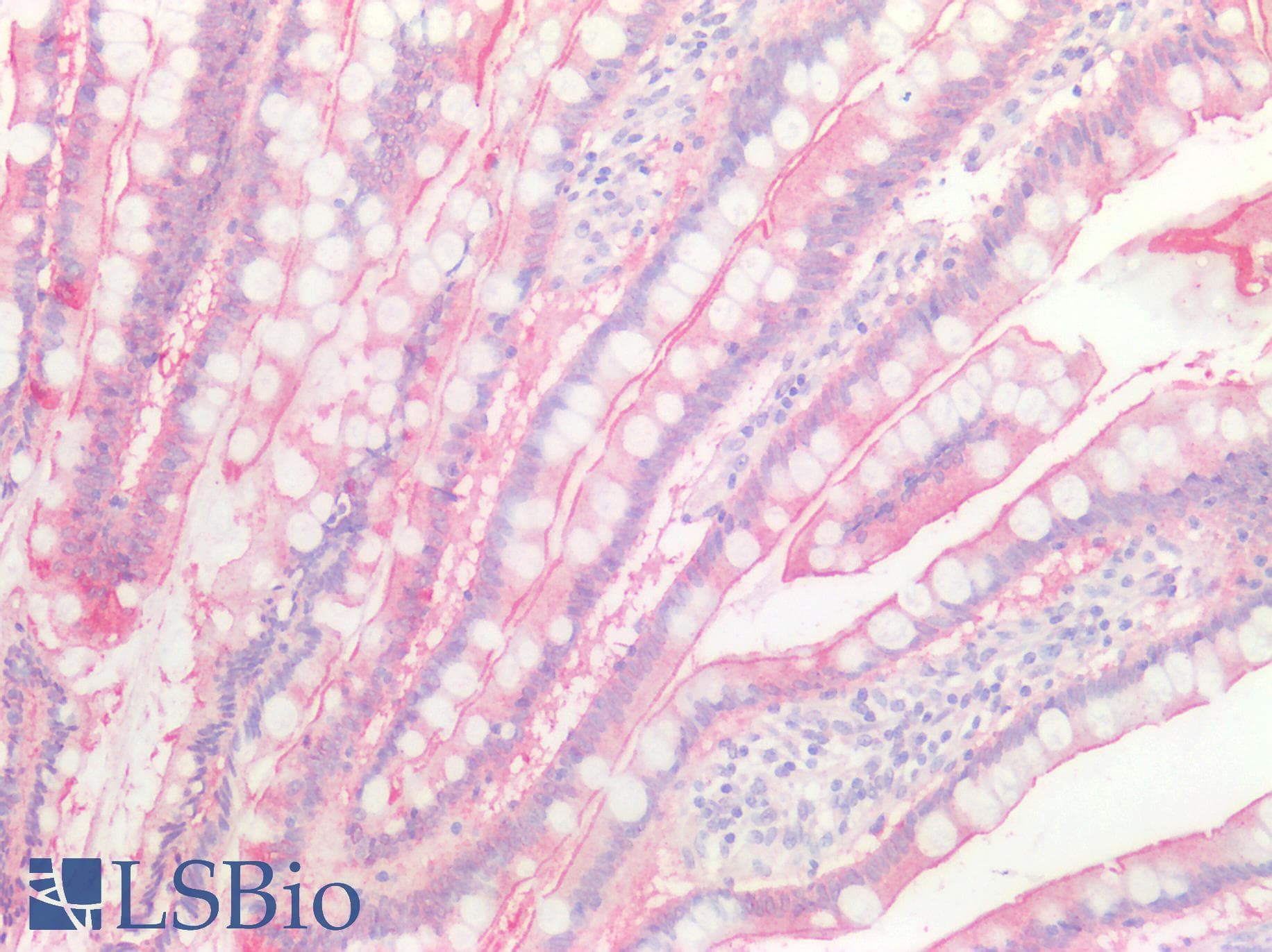 IHC-plus™ VIL1 / Villin Antibody (aa1-350)
