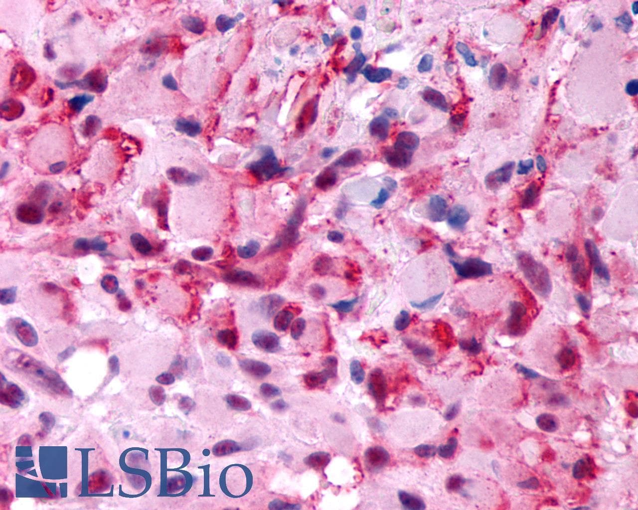 PathPlus™ HTR2B / 5-HT2B Receptor Antibody (Extracellular Domain)