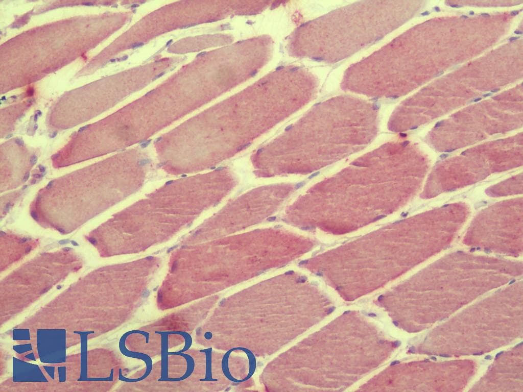 IHC-plus™ Polyclonal Rabbit anti-Human C2orf40 / ECRG4 Antibody (IHC, WB)
