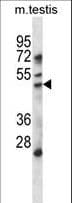 HDAC11 Antibody (aa197-226)
