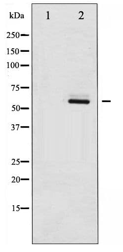 Polyclonal Rabbit anti-Human SRC Antibody (phospho-Ser75, IHC, WB)