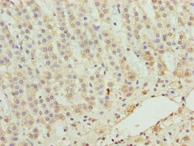 ZNF226 Antibody