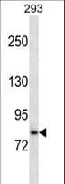 SLC39A6 / LIV-1 Antibody (aa437-466)