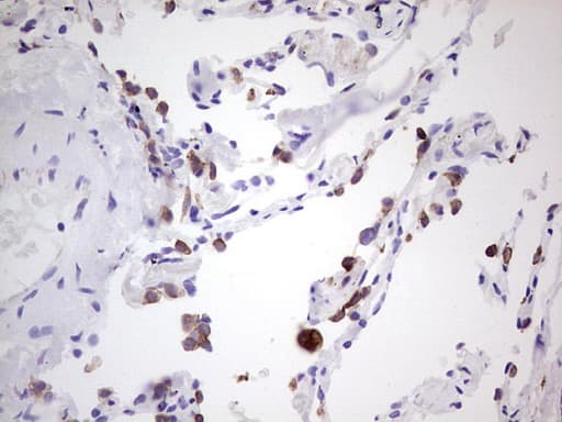 Peripherin Antibody (clone OTI3F4)