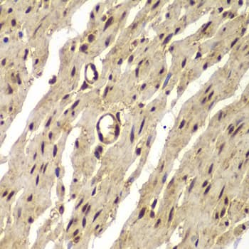 IHC-plus™ Polyclonal Rabbit anti-Human PSMB8 / LMP7 Antibody (IHC, IF, WB)