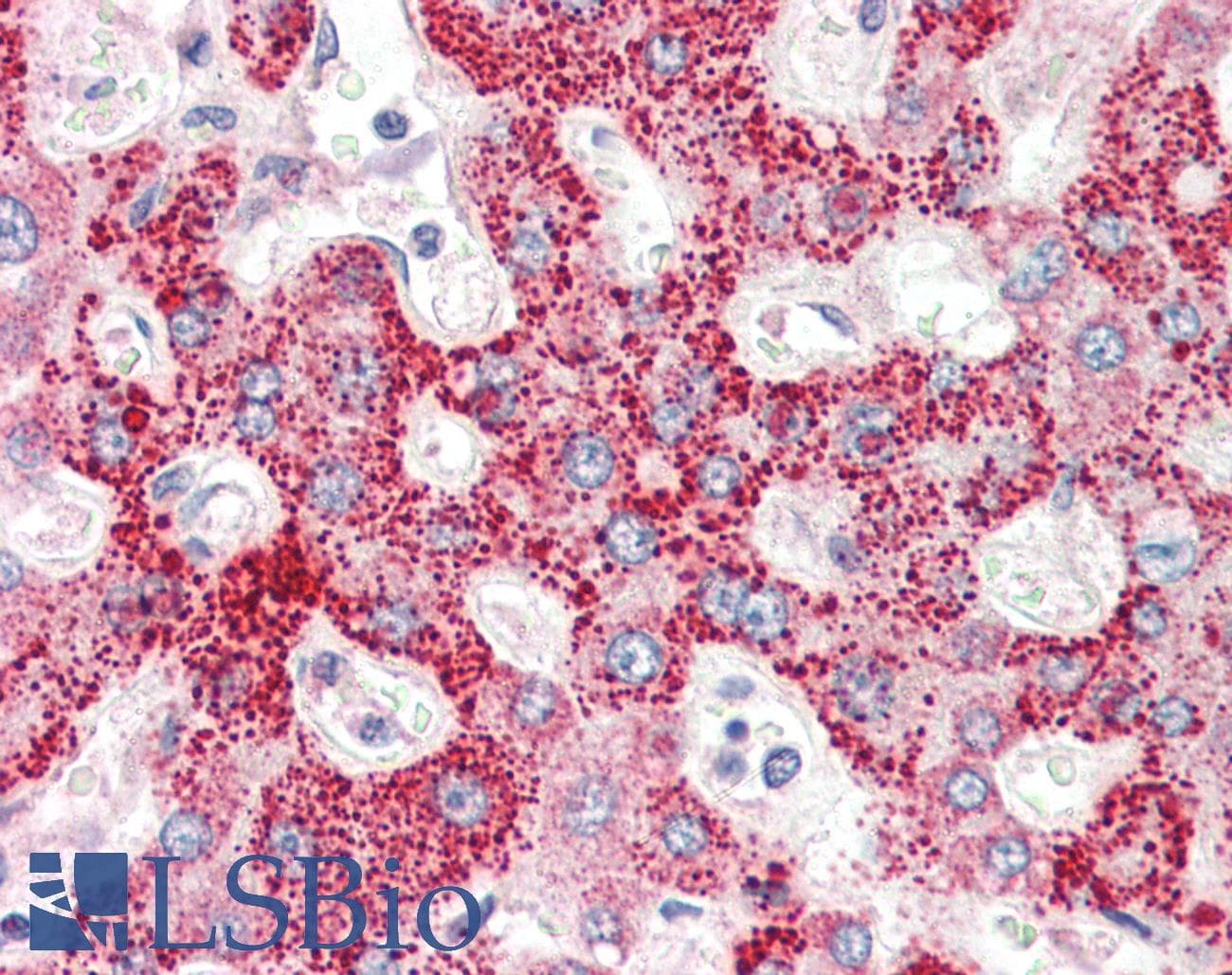 IHC-plus™ Polyclonal Rabbit anti-Human CRLF2 / TSLPR Antibody (IHC, IF, WB)