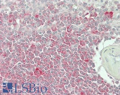 IHC-plus™ WDR77 / MEP50 Antibody (aa292-342)