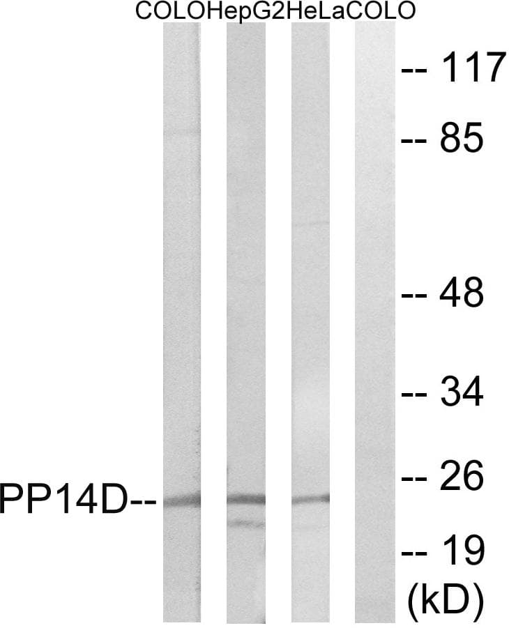 PPP1R14D / CPI17-Like Antibody