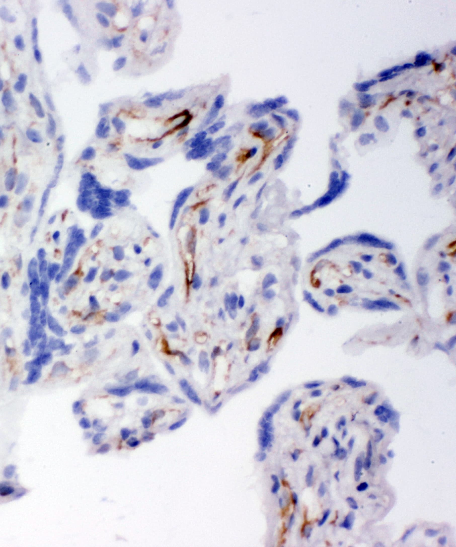 Polyclonal Rabbit anti-Human HSD17B2 Antibody (aa373-387, IHC, WB)