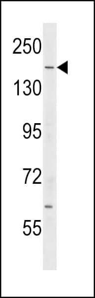 IQGAP2 Antibody (aa1436-1463)