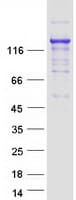 Human KDM3A / JMJD1A Protein (Recombinant Myc-DDK (Flag))