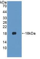 KRT1 / CK1 / Cytokeratin 1 Antibody (aa487-644, Biotin)