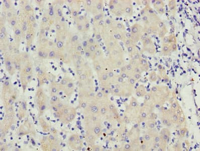 MCCC2 / MCCB Antibody