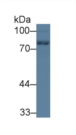 NF-L / NEFL Antibody (aa281-396, PE)