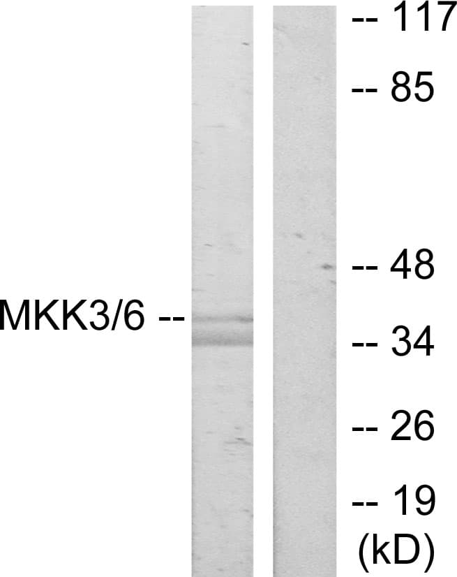 IHC-plus™ MAP2K3 / MEK3 / MKK3 Antibody (aa173-222)