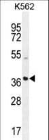 SFRP4 Antibody (aa318-346)