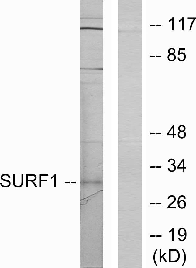 IHC-plus™ SURF1 Antibody (aa171-220)