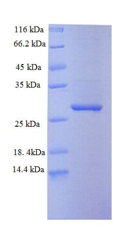 Mouse SAMHD1 Protein (Recombinant His)