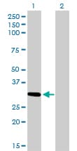 HZF16 / ZNF124 Antibody (clone 4G4)
