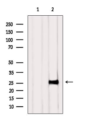 Polyclonal Rabbit anti-Human NAA11 / ARD1B Antibody (WB)