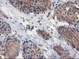 GBA3 / CBG Antibody (clone OTI1F1)