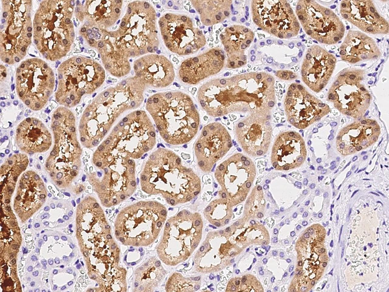ACY3 Antibody