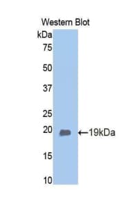 Adiponectin Antibody (aa111-244)