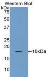 AHSP / EDRF Antibody (aa1-102, FITC)