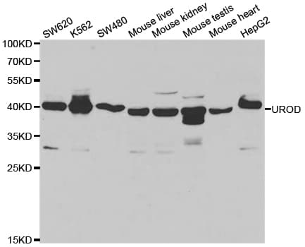 Polyclonal Rabbit anti-Human UROD Antibody (IHC, IF, WB)