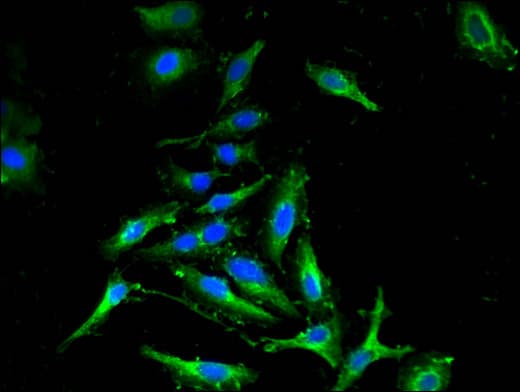 CDKN2C / p18 INK4c Antibody