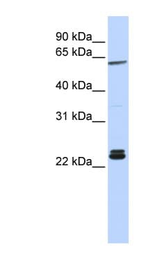 H1F0 Antibody (aa36-85)