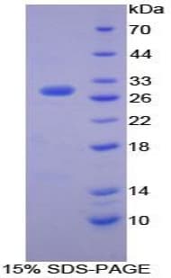 Mouse MMP15 Protein (Recombinant His-T7)