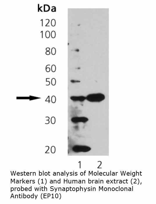 SYP / Synaptophysin Antibody (clone EP10)