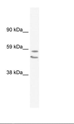 PathPlus™ EGR2 Antibody (aa397-446)
