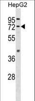 Polyclonal Rabbit anti-Human FAAH Antibody (aa501-529, WB)