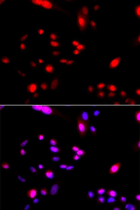 IHC-plus™ Polyclonal Rabbit anti-Human Cullin 4A / CUL4A Antibody (IHC, IF, WB)