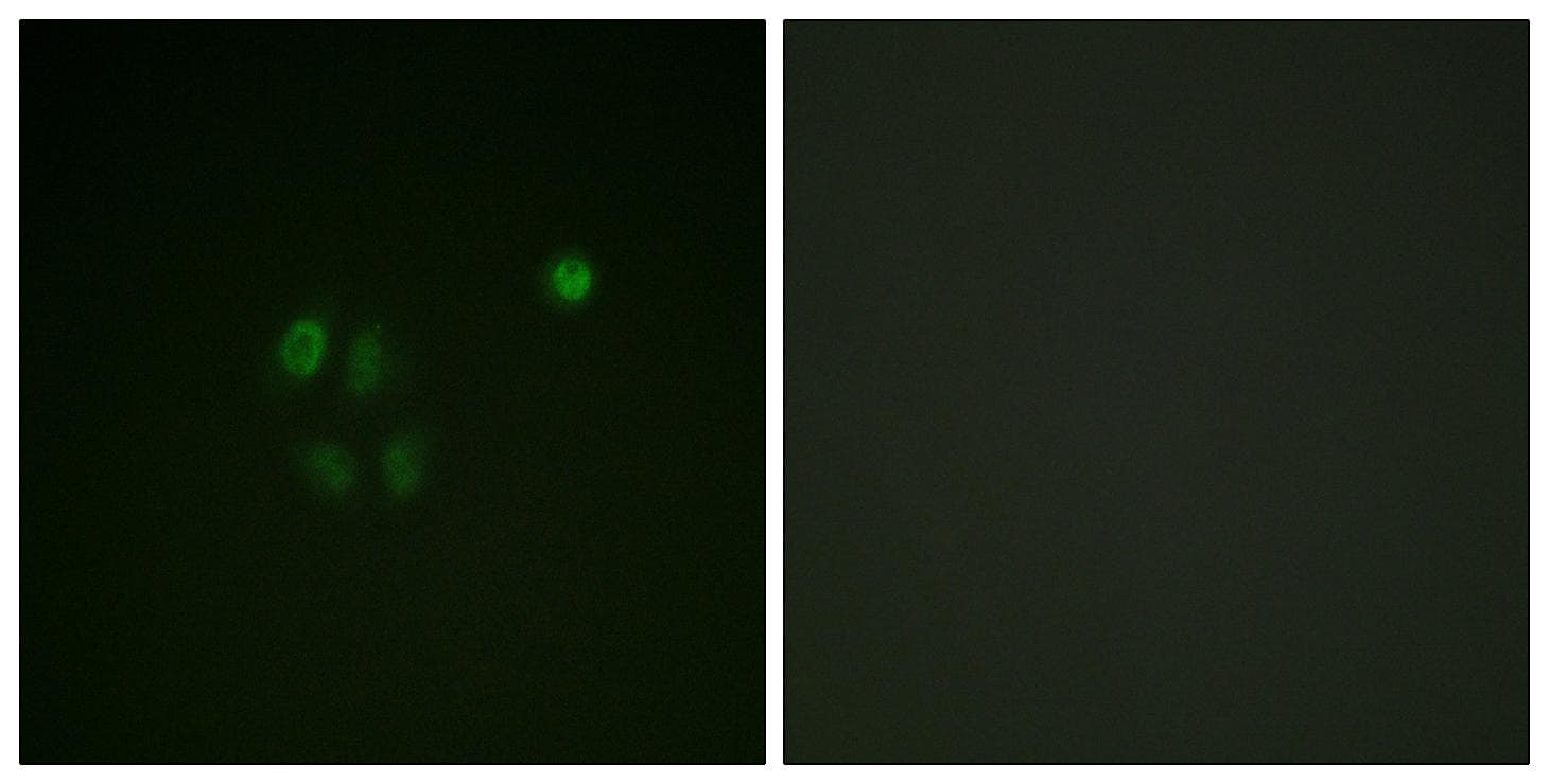 CHEK1 / CHK1 Antibody (Ab-301)