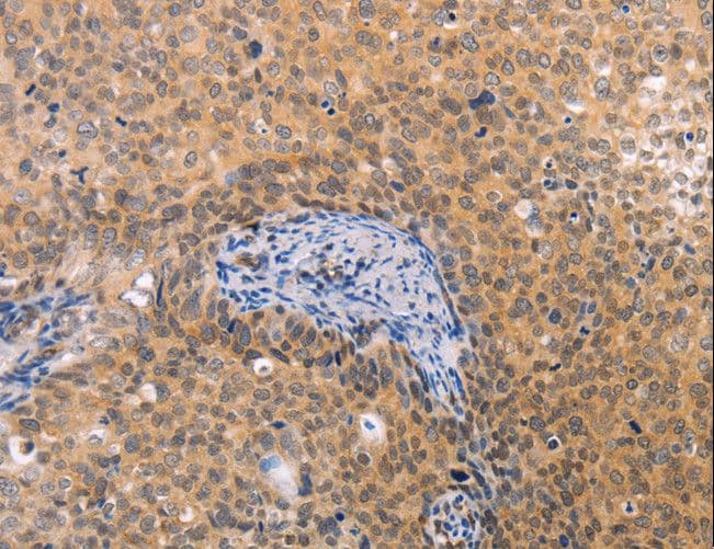 VHL / Von Hippel Lindau Antibody