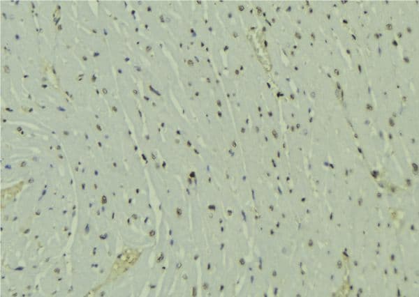 Polyclonal Rabbit anti-Human HOPX / HOP Antibody (IHC, WB)
