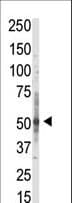 PRMT3 Antibody (aa142-173)