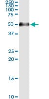 AGER / RAGE Antibody (clone 1C1)