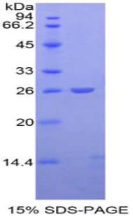 Mouse APC Protein (Recombinant His-T7)