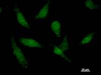 TAF15 Antibody (clone TAF15B11A6)