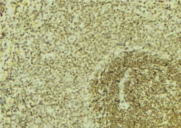 CBS Antibody